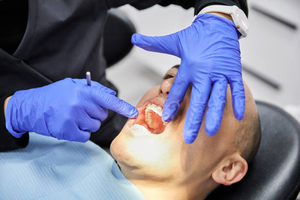 Best Chipped Tooth Repair Near Me  in Mayflower Village, CA