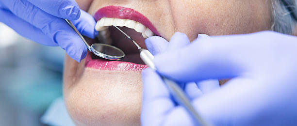 Best Walk-In Dentist Near Me  in Mayflower Village, CA